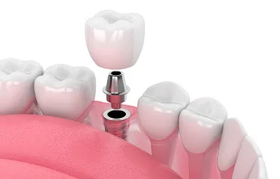 Orthodontics Windsor