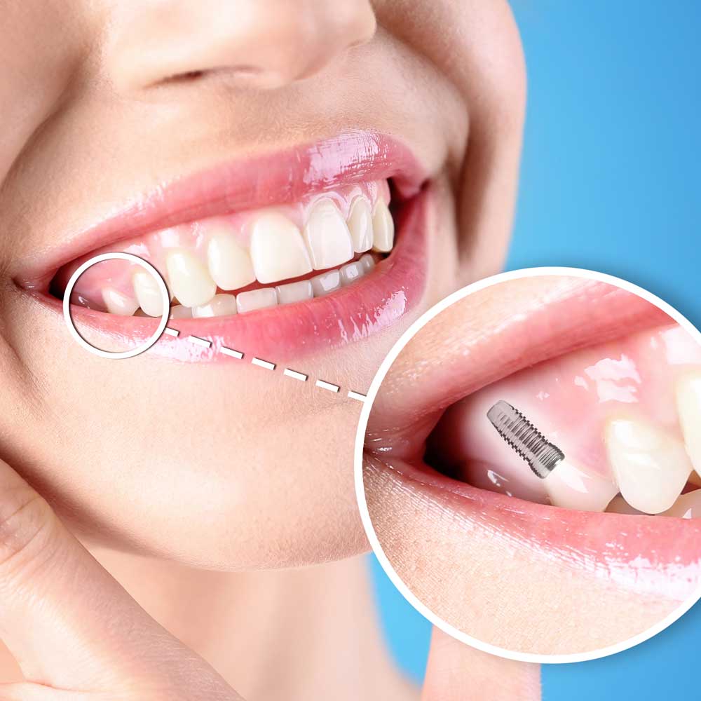 dental