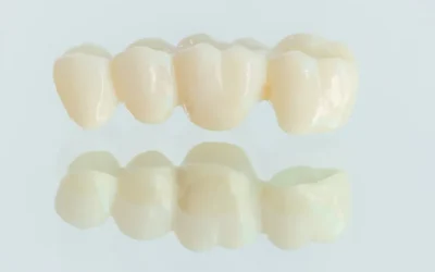 How a Dental Bridge Benefits Your Smile