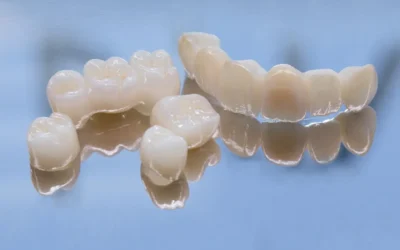 How Different Materials Affect Your Dental Restoration