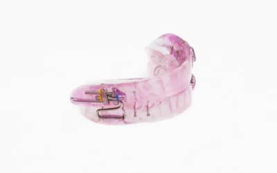 What to Expect From Your Sleep Apnea Oral Appliance