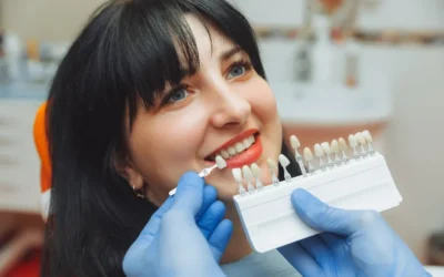 Is a Full Smile Makeover Worth Getting?