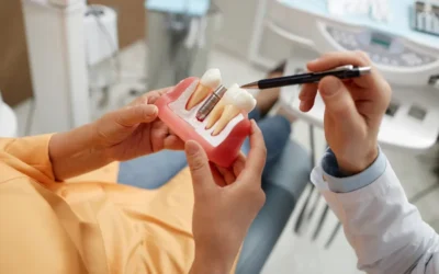 How to Care for Your Dental Implants for Long-Term Success