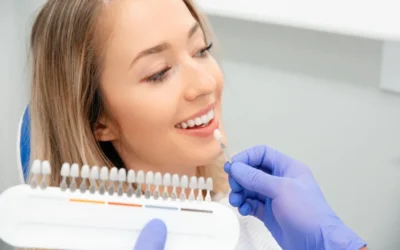 How Well Does Professional Teeth Whitening Actually Work?