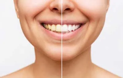 Windsor Dentist