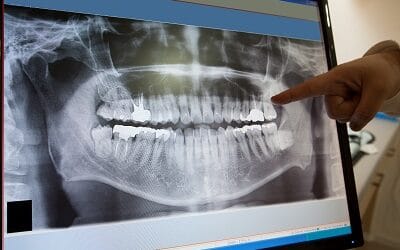 What is Considered Oral Surgery?