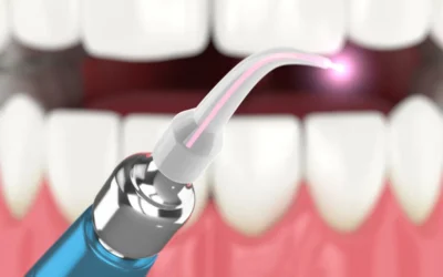 How Lasers Are Transforming Restorative Dentistry
