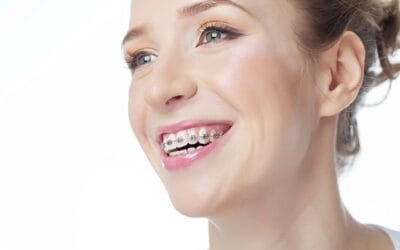 Questions to Ask When Looking for an Orthodontist