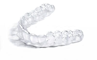 Why Go to a Dentist for Clear Aligners?