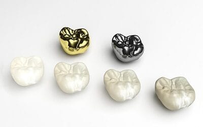 How Important is Your Choice of Dental Crown Material?