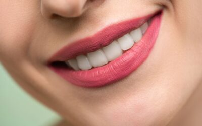 How Long Do Porcelain Veneers Actually Last?